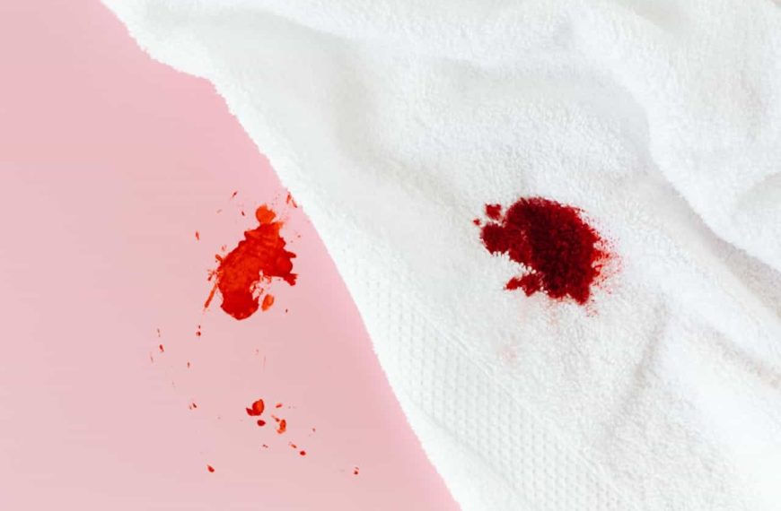 White towel with red stains, placed on a pink surface, splattered red liquid on both towel and background, visible fabric texture and absorbent pattern