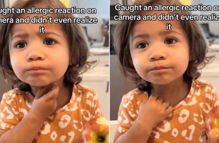Mom Records Daughter Eating an Apple — and Only Later Realizes She Captured an Allergic Reaction Unfolding