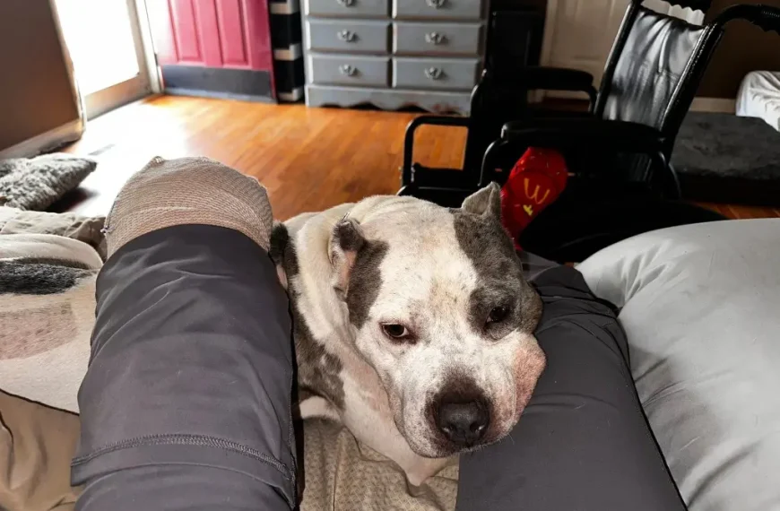 Tennessee Mom Loses Leg After Pit Bull Attack Left Her Limb “Basically Hanging Off”