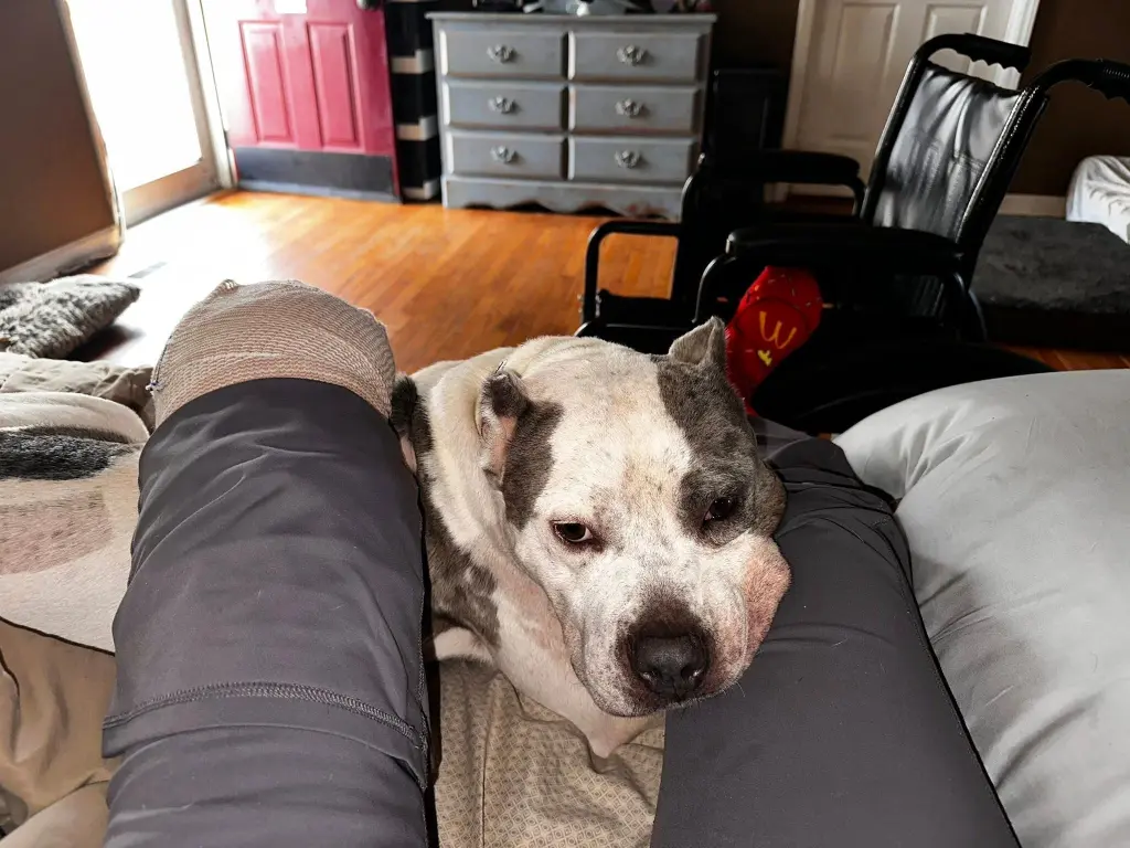 Tennessee Mom Loses Leg After Pit Bull Attack Left Her Limb “Basically Hanging Off”