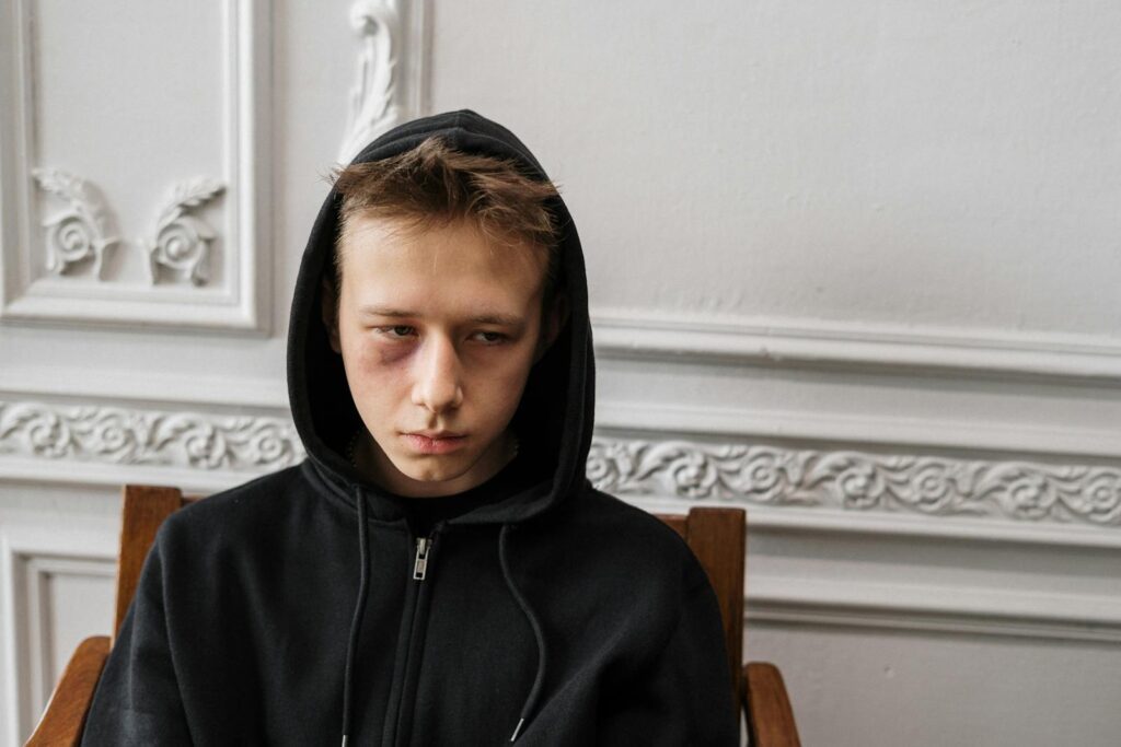 A young male sitting indoors, wearing a black hoodie with a visible bruise, showing a contemplative expression.