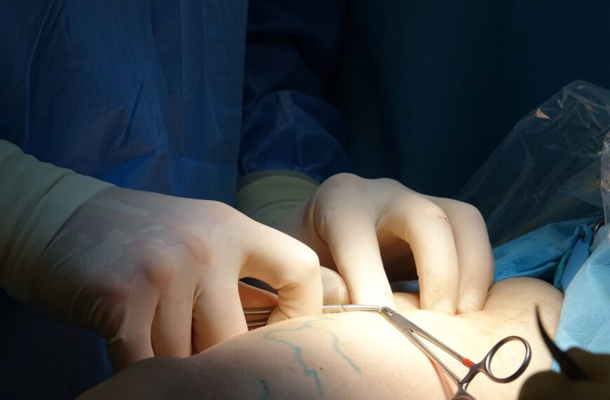Detailed image of a surgeon's hands during a medical procedure in an operating room.